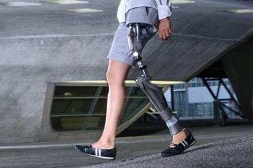 Hofteledsprotese med iglidur lejer af Otto Bock HealthCare GmbH